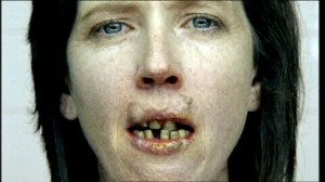 Typical health warning image on Australian cigarette packs -mouth cancer